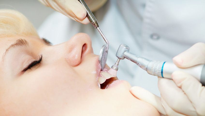 טיפול שיניים משקם